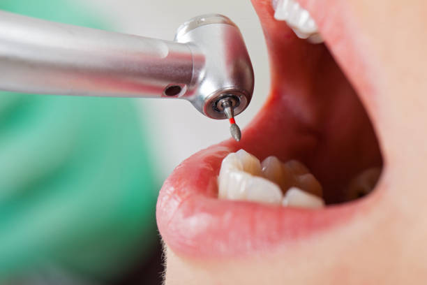 Emergency Dentist for Kids in MI